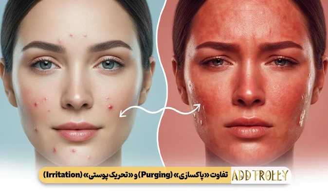 تفاوت «پاکسازی» (Purging) و «تحریک پوستی» (Irritation)